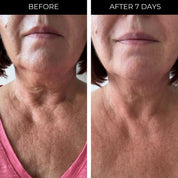 Ageless Throat & Decolletage Serum