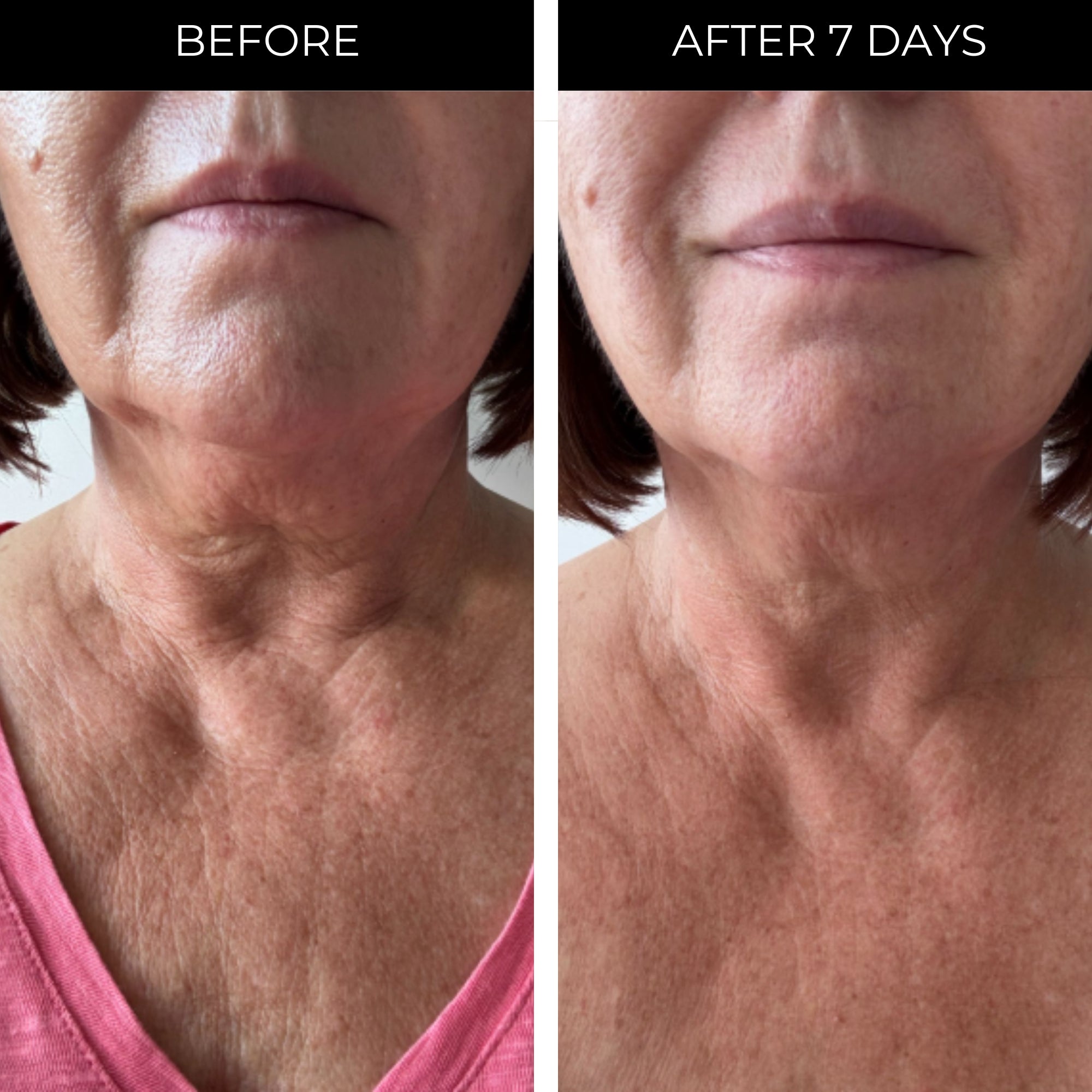 Ageless Throat & Decolletage Serum