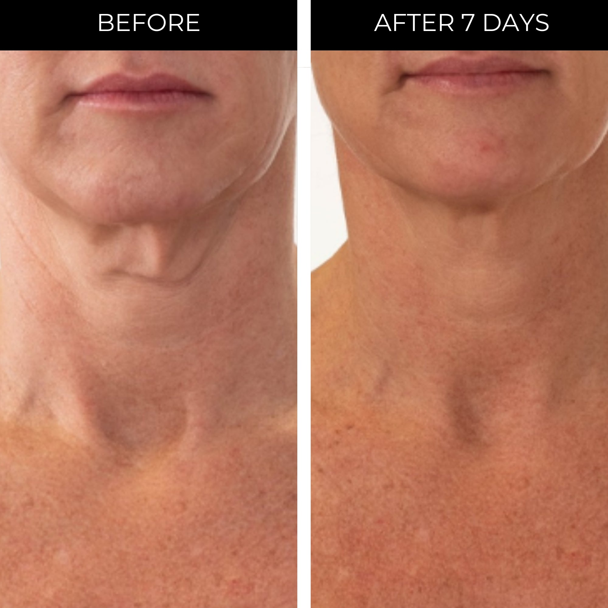Ageless Throat & Decolletage Creme