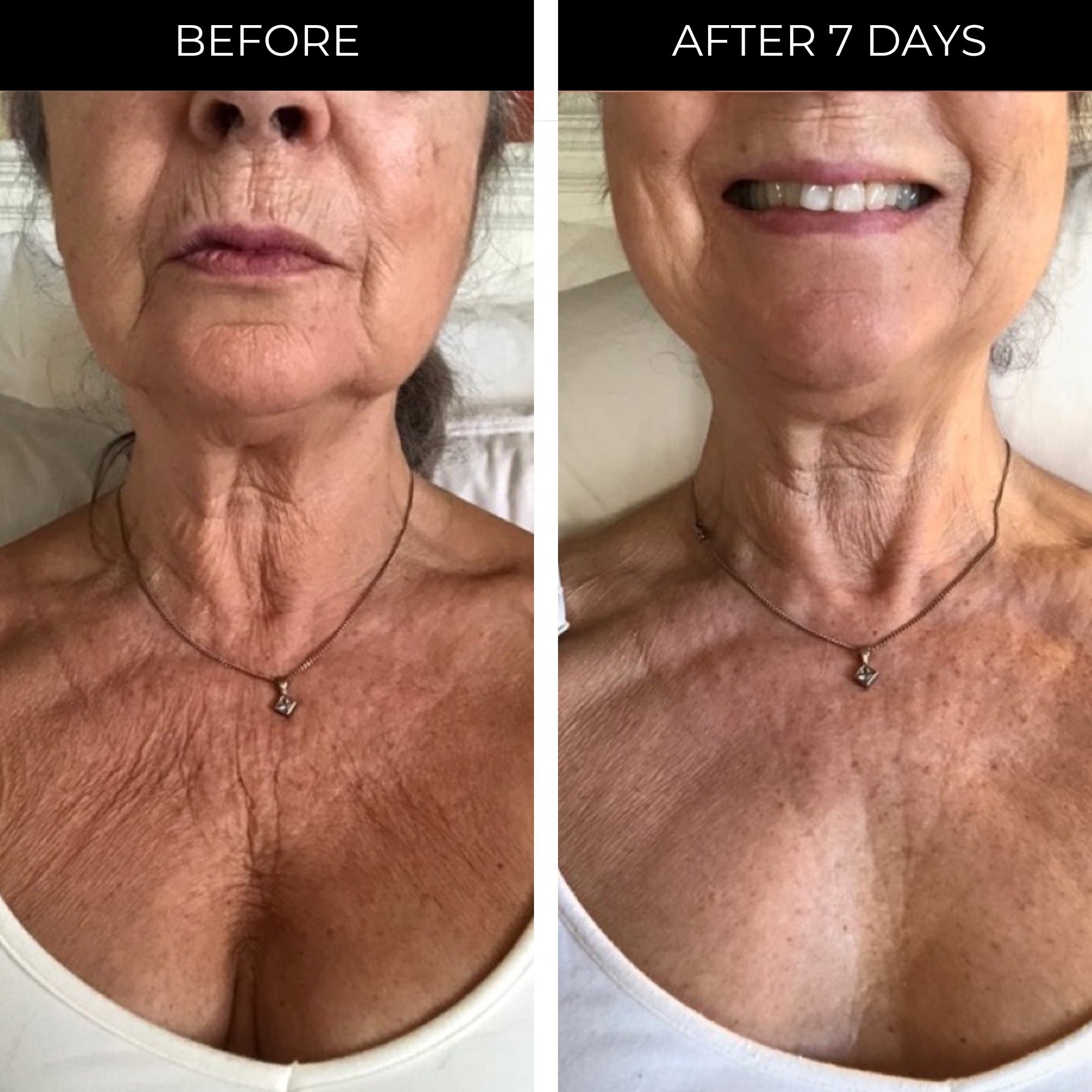 Ageless Throat & Decolletage Creme