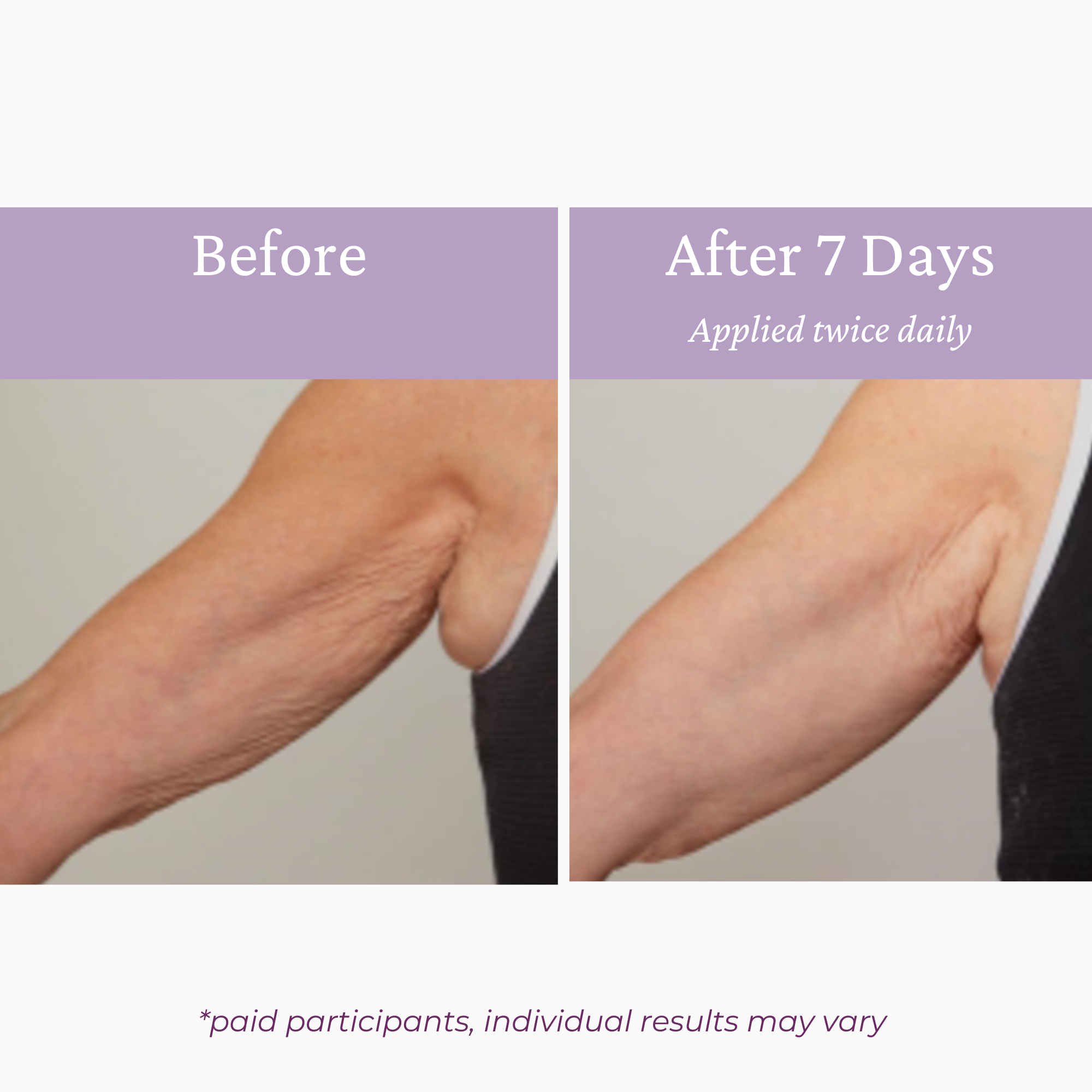 Ageless Upper Arm Creme PRAI Beauty UK