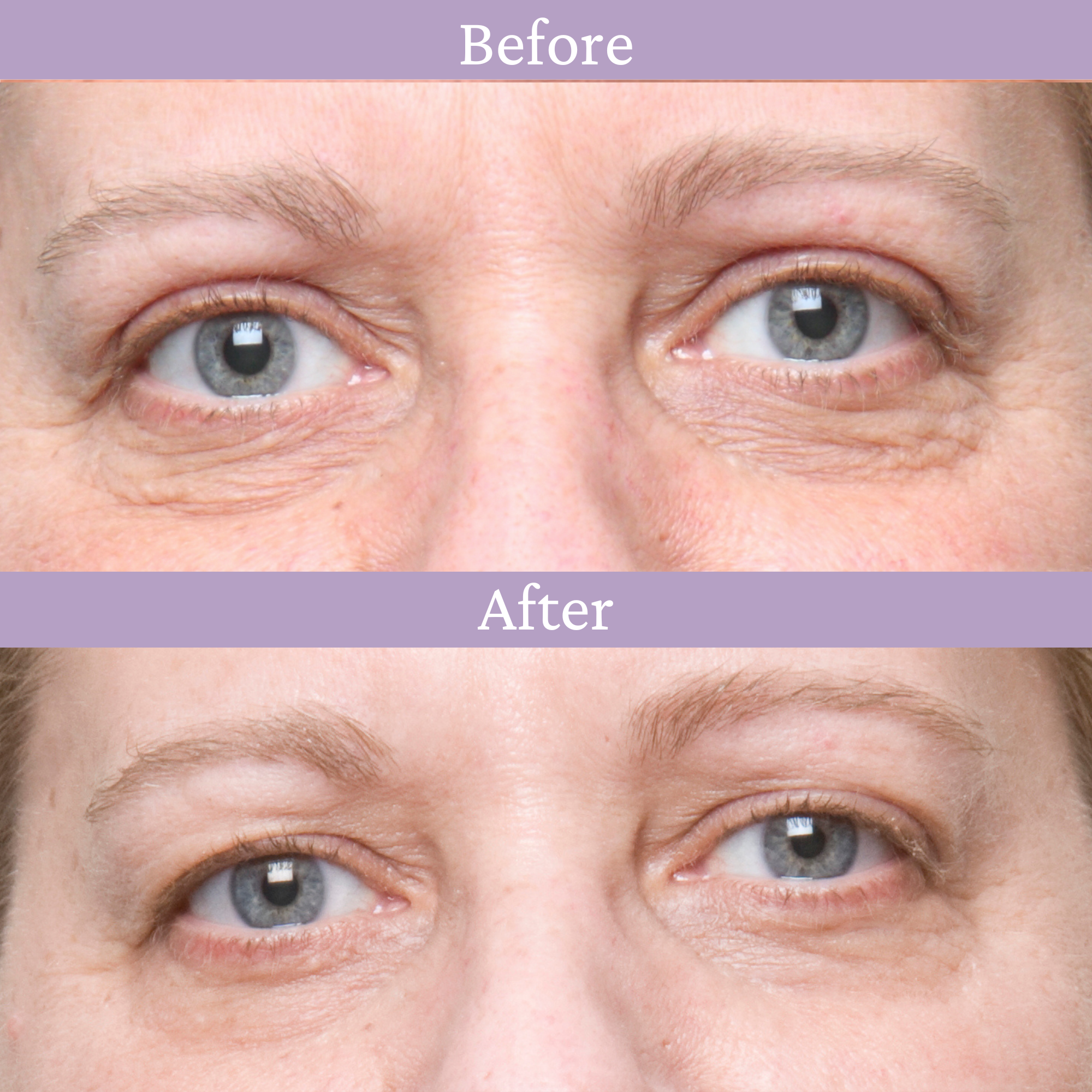 Eye crease best sale